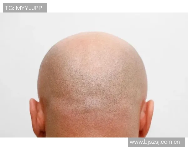 美记建议布朗剃光头更省心发际线粉不如简单直接